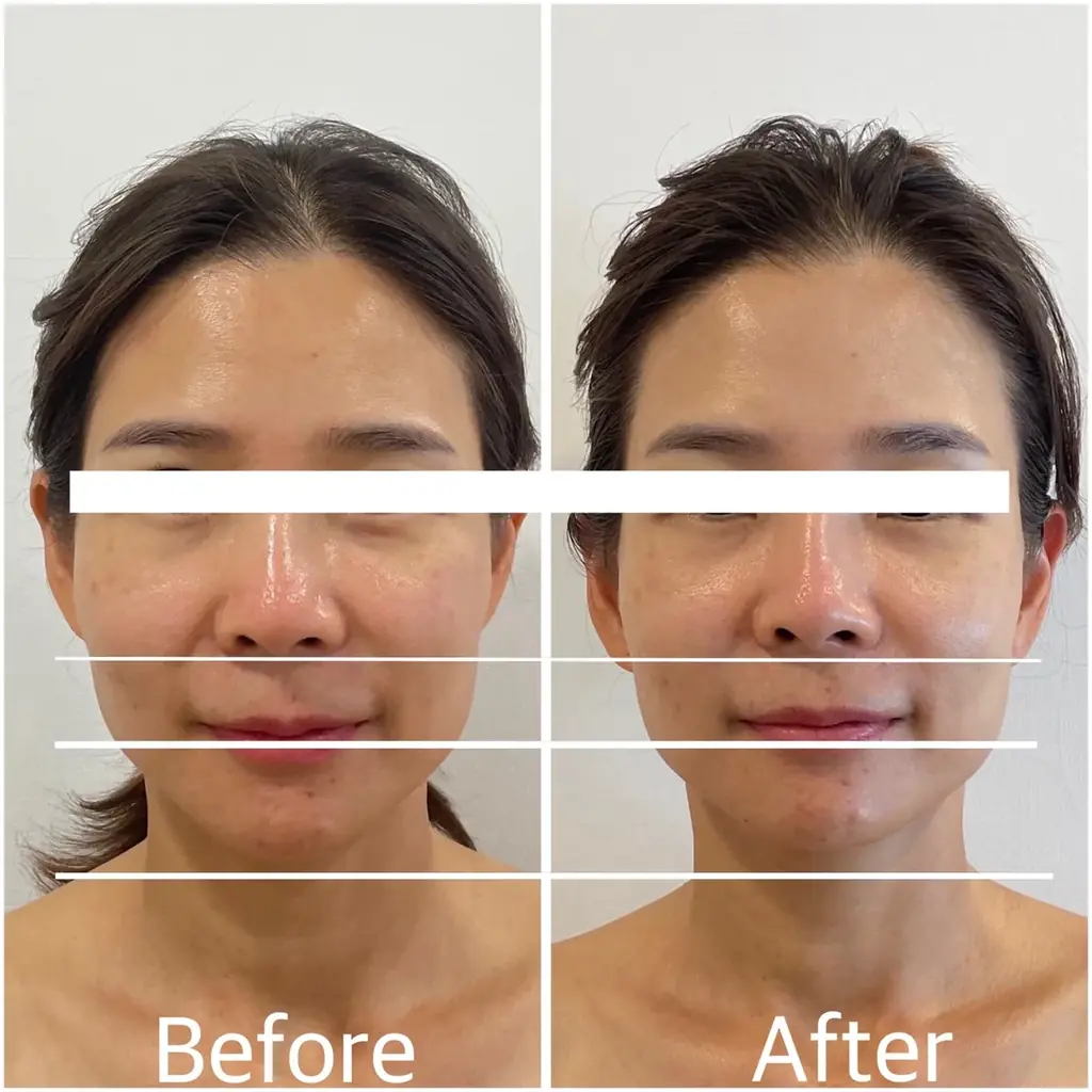 【株式会社Dr.Visea】放置しながら売り上げ1.5倍を実現！エステサロン向け中顔面短縮マシン ダリマスク予約販売開始 画像 2