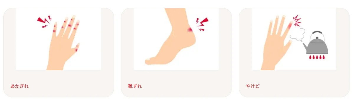 バンドエイド®×YouTube チャンネルCOCHO COCHO コラボ「チャレンジにパワーを届けよう！」駅ナカ広告を掲載開始！ 画像 8