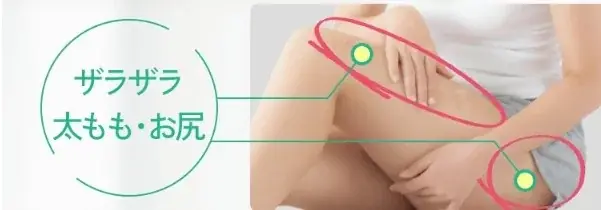 ＼夏前の今／二の腕のポツポツ*ざらつきに　塗るだけ簡単ボディ用美容液 画像 5