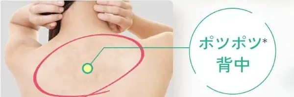 ＼夏前の今／二の腕のポツポツ*ざらつきに　塗るだけ簡単ボディ用美容液 画像 6