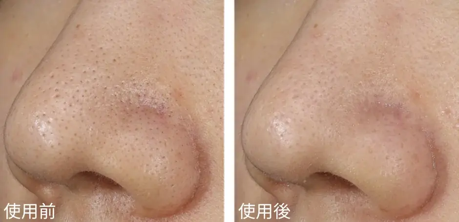 洗顔料市場20年連続売上No.1*1ブランドの「ビオレ」から日本初*2毛穴の“隠れ角栓まで自己崩壊”させる『ビオレ おうちdeエステ ディープクレイ洗顔』誕生 画像 2