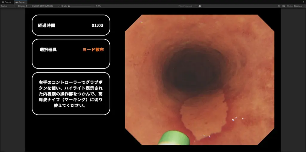 【限定10施設】高難度手技ESDをVRで高精度に再現。XR Japan、内視鏡VRトレーニングシステム「EIR（エイル）ベータ版」を無料配布 画像 6