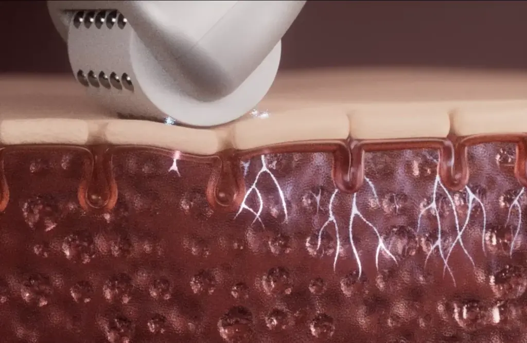 アークポレーション技術採用のスキンオープナー「CELORABY ペンタショット」、楽天カテゴリー1位を獲得 画像 4