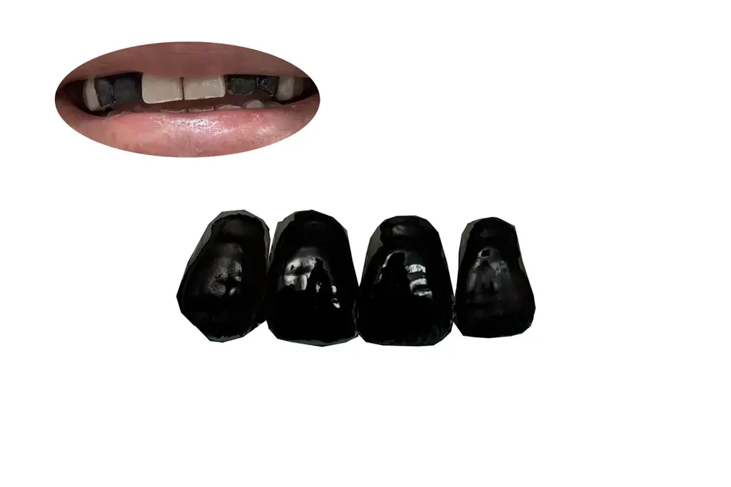 歯を黒にメイクする、新しい表現。“陰影”と“アクセント”で表情をデザインする歯の化粧品を新発売! 画像 2