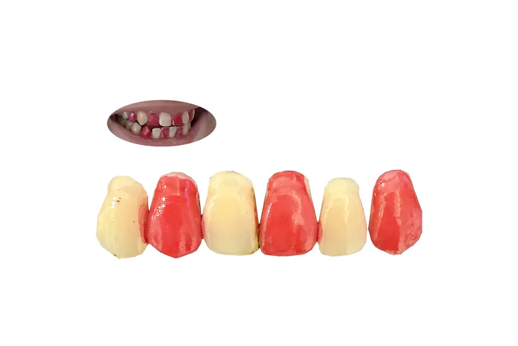 歯を赤にメイクする、新しい表現。“赤と白の対比”で口元にパターンをつくる歯の化粧品を新発売！ 画像 2