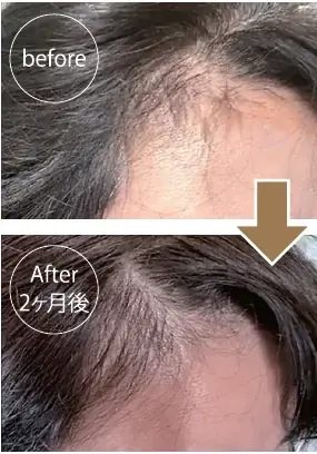 memi’s angelly hair の新商品「スカルプセラムkokuikuＥＸ」を5月18日より発売 画像 5