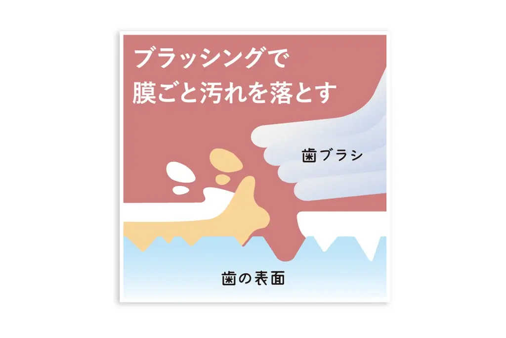 結婚式当日、最も輝く白い歯へ。ドレスに合わせて白い歯に“ドレスアップ”。ブライダル専用の歯の化粧品『コスメティースB Bridal』新発売 画像 5