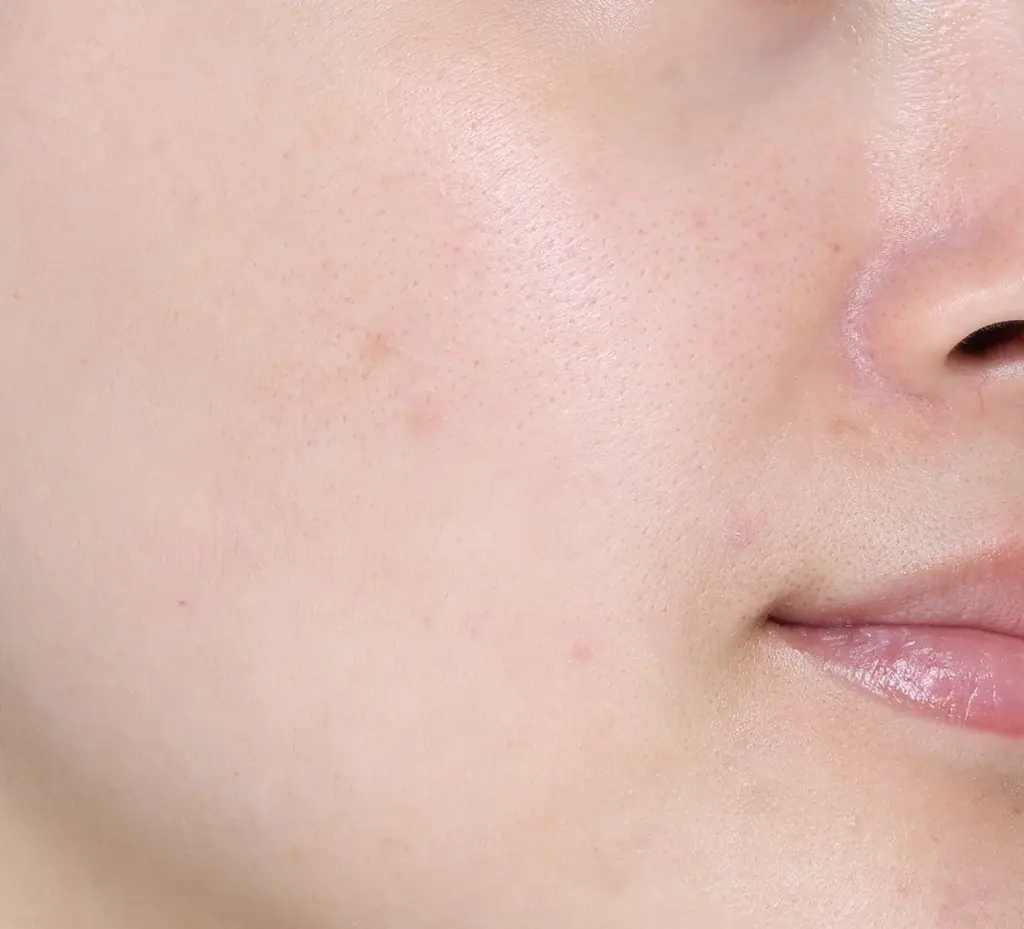 生肌質感ハイカバーつづく。キメの形を美しく再現し、生き生きとした肌仕上がりを叶えるファンデーション登場「ソフィーナ　プリマヴィスタ　生肌カバーバーム　ファンデーション」 画像 6