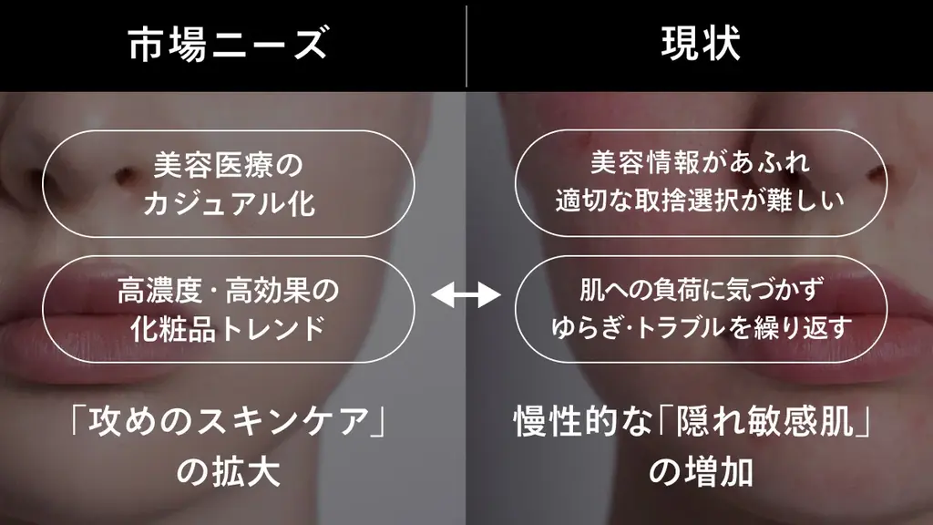 【SISI】攻めの肌管理に、味方を。次世代敏感肌*¹スキンケアTECAシリーズ誕生。 画像 2