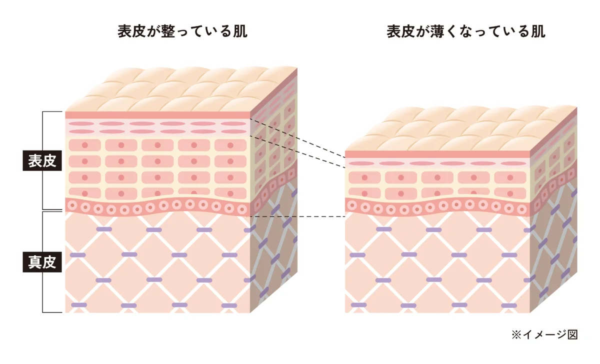 薄肌用スキンケアブランド「imaét -イマエット-」が誕生。最先端サイエンスに基づく美容液発想の化粧水「モイストヴェールセラムローション」、オイル美容液「メルティウィズオイル」9/1(火)同時発売。 画像 3