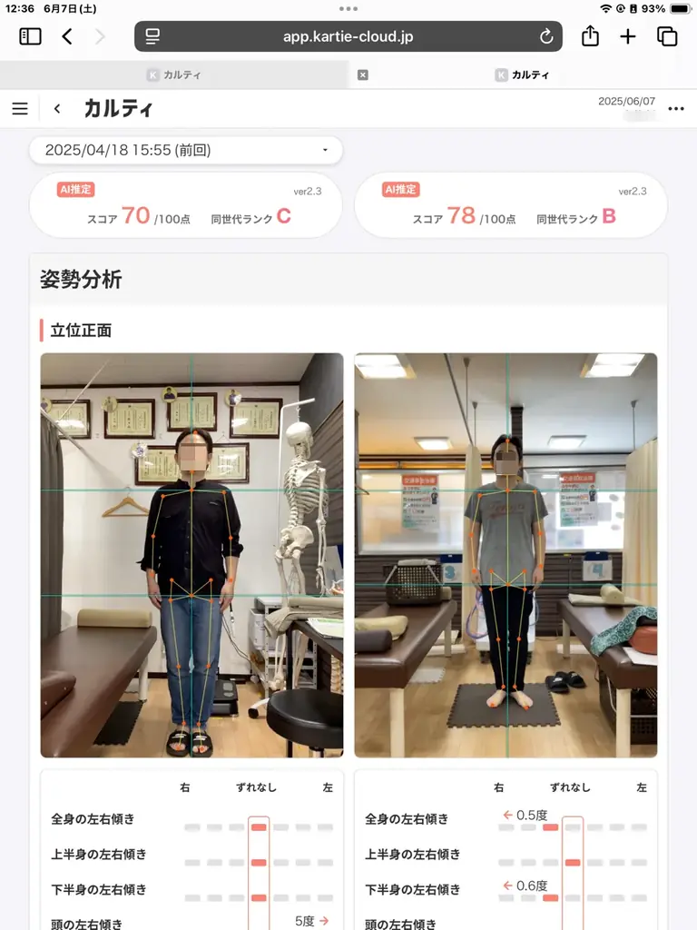 AI姿勢診断・ダイエット＆ボディメイク遺伝子検査など最新システム導入　カラダサポート鍼灸接骨院・瘦身&小顔専門サロン ビオラスの太田藤阿久店が6月20日（金）同時オープンで無料体験会などを開催 画像 9