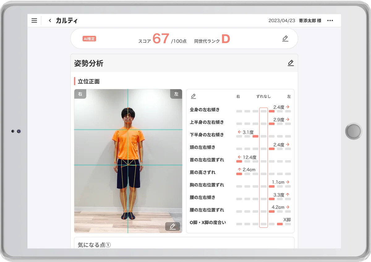 Sapeet、AI姿勢分析「カルティ シセイカルテ」を万博公式関連イベント「Japan Health」に出展 画像 2