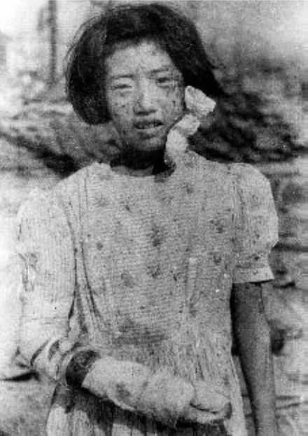 2025年5月31日開始「ヒロシマ1945」写真展で原爆の実態を学ぶ