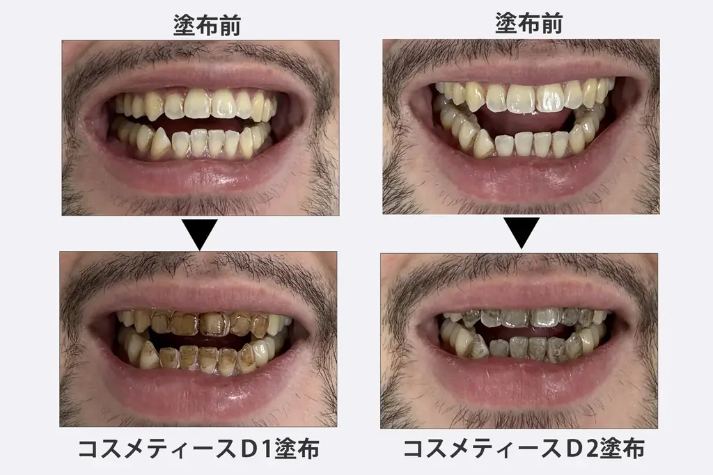 歯に“役を与える”という新発想!演劇用歯の化粧品「コスメティース・ダーティコート(D1、D2)」新発売! 画像 4