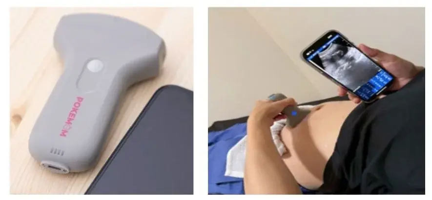 7月7日発売！スマホで胎児映像と心音が聴ける新超音波デバイス