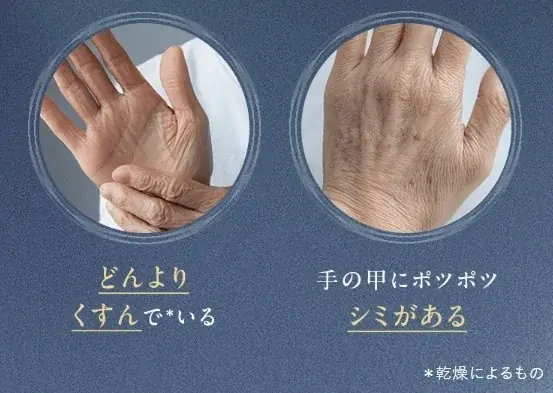 就寝前の新習慣！夜1回の集中ケアでふっくらハリのある手もとへ〈薬用ナイトハンドセラム〉誕生 画像 3