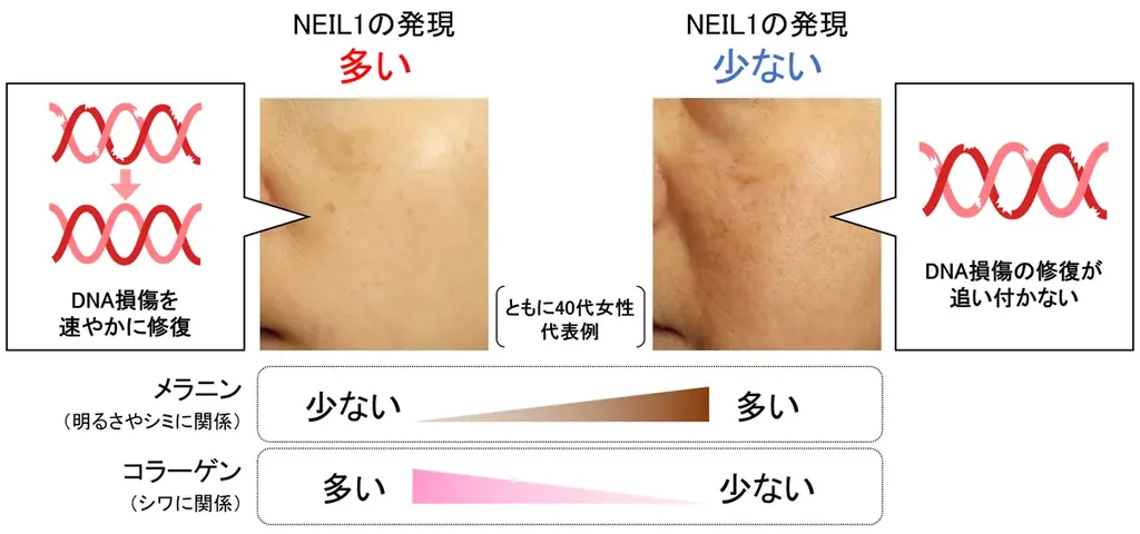 7月8日発表｜DNA修復酵素NEIL1が肌の美しさに与える影響とは