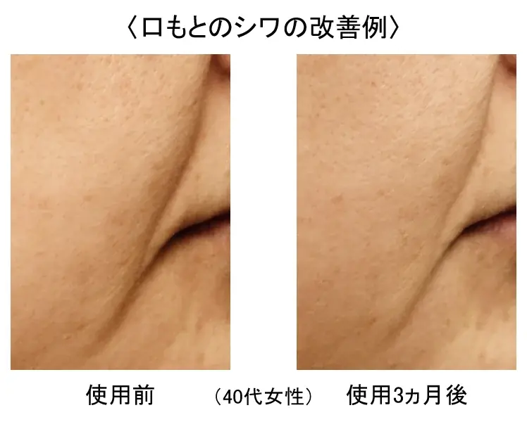 霊芝の亜臨界水抽出物が肌のDNA修復能力を高め、様々な肌悩みを改善することを発見 画像 2