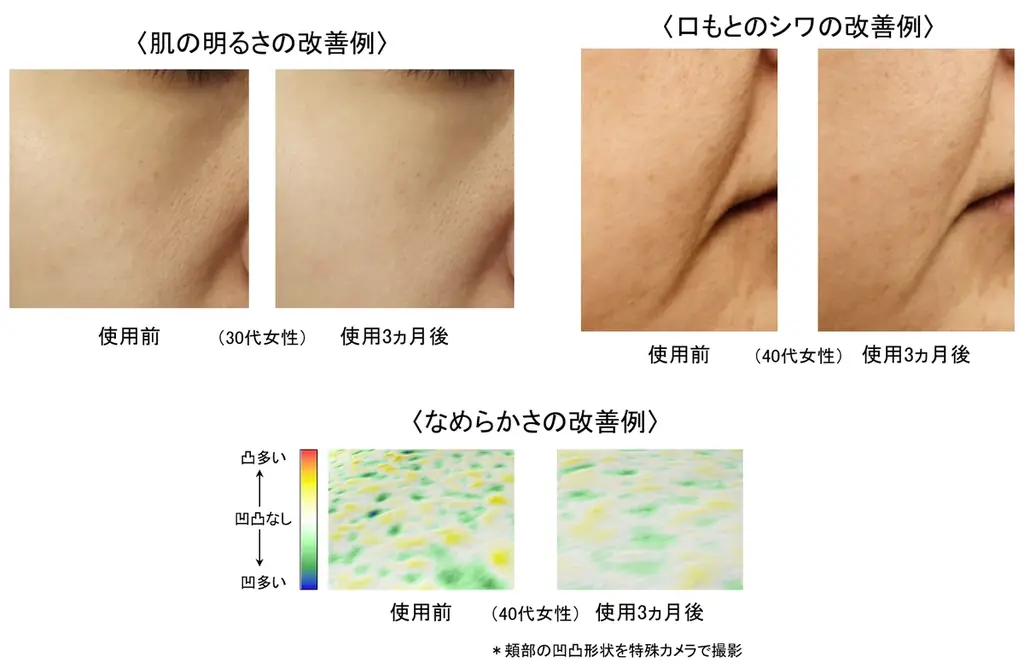 霊芝の亜臨界水抽出物が肌のDNA修復能力を高め、様々な肌悩みを改善することを発見 画像 5