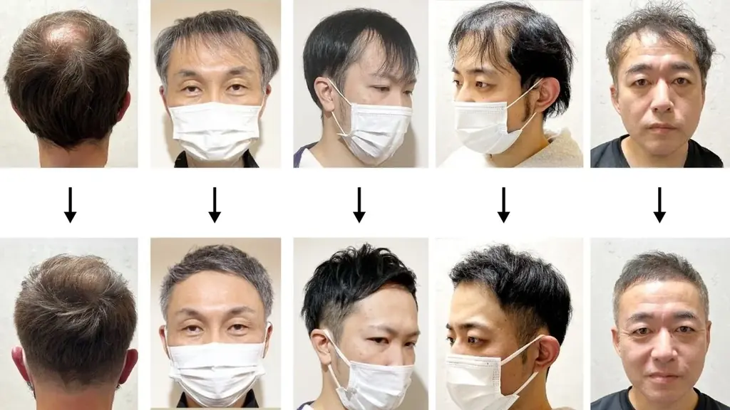 【新規4店舗同時オープン】薄毛専門美容室 RELIVE、愛知に3店舗・東京に新店舗 画像 7