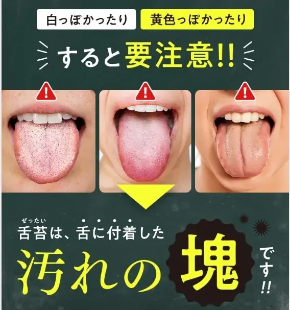 1粒で息スッキリ!リフレッシュ!*¹ なめるだけで、口臭の原因の舌の奥の汚れもケア〈クリーンタンブレス〉再登場 画像 2