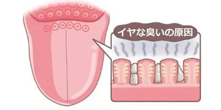 1粒で息スッキリ!リフレッシュ!*¹ なめるだけで、口臭の原因の舌の奥の汚れもケア〈クリーンタンブレス〉再登場 画像 5