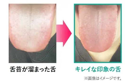 1粒で息スッキリ！リフレッシュ！*¹　なめるだけで、口臭の原因の舌の奥の汚れもケア〈クリーンタンブレス〉再登場 画像 7