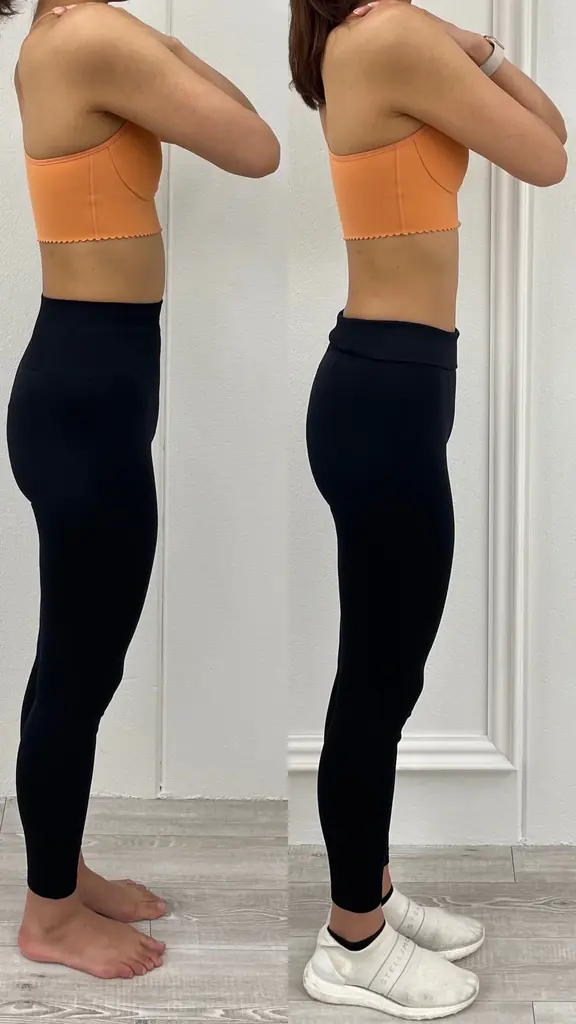 日本初、“腸×姿勢”のダブルアプローチで挑む 新・ダイエット革命〜14日間で「30代からの痩せにくさ」に終止符〜累計5万人超の指導実績から生まれた、“美と健康の再起動プログラム”を広島で開発 画像 13