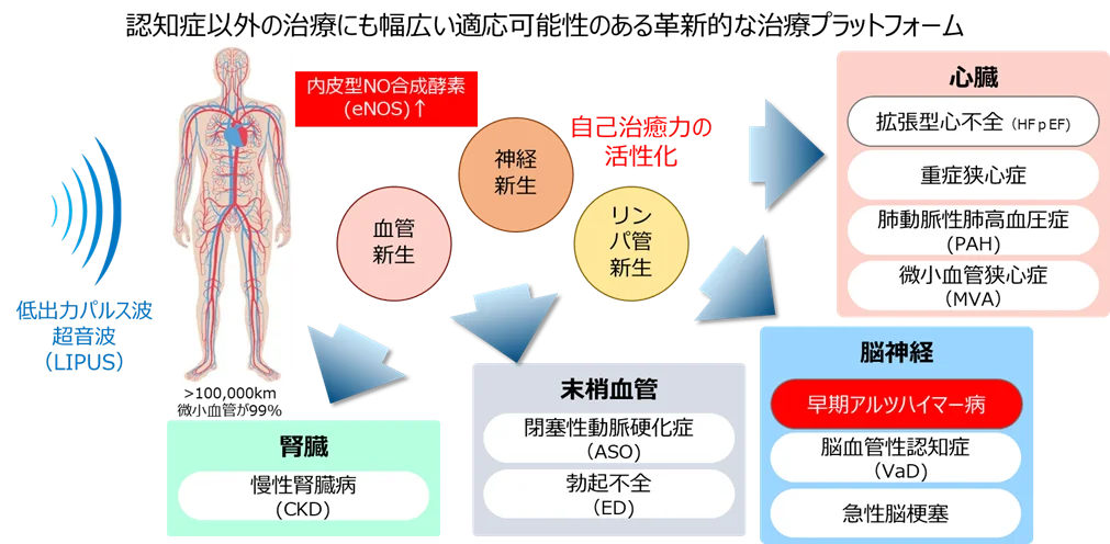 LIPUS製造販売提携