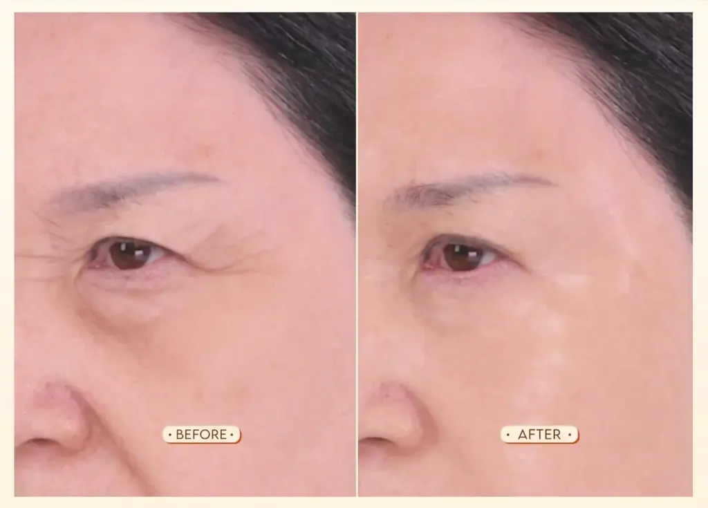 30秒でシワがピンと復活 ナインテイルズ下地の実力｜ベストカレンダー