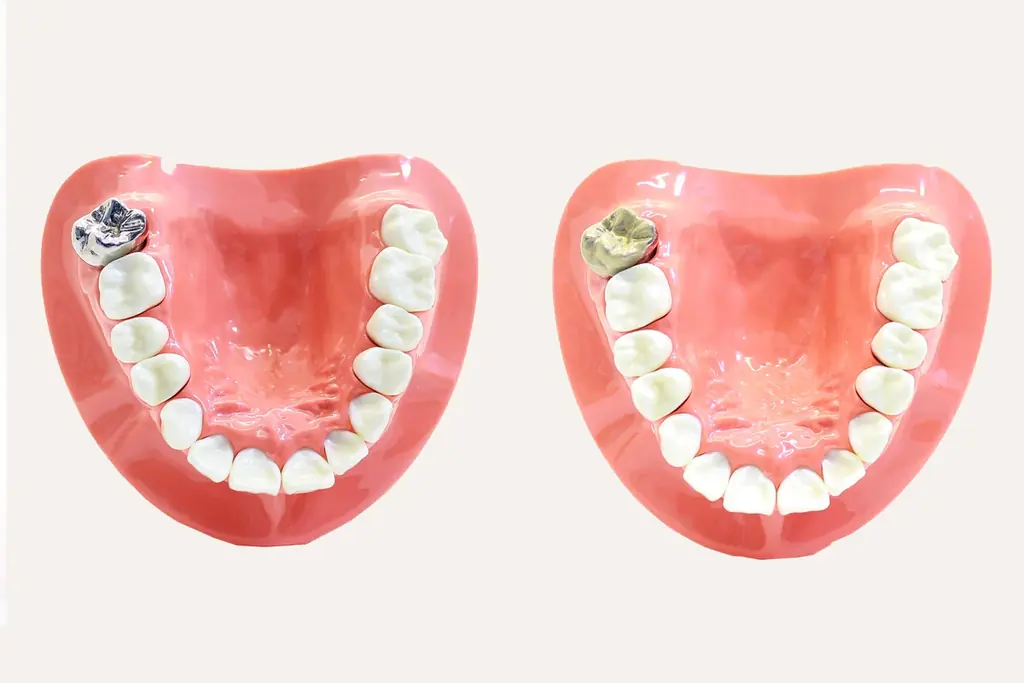 口を開けたときに奥歯・銀歯の”気になる色を隠す”歯の化粧品新発売！ 画像 2