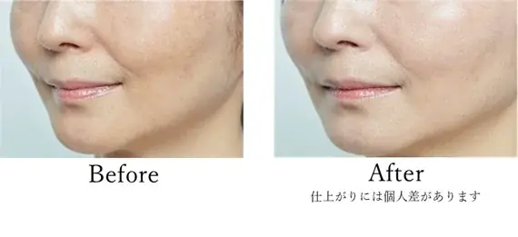 肌へのやさしさと高いUVカット効果を実現。なめらかに肌にフィットして、肌悩みを自然にカバーする、焼け止め兼化粧下地「サンノット スキンプロテクトトーンアップUV」2025 年 11月 6日発売 画像 2