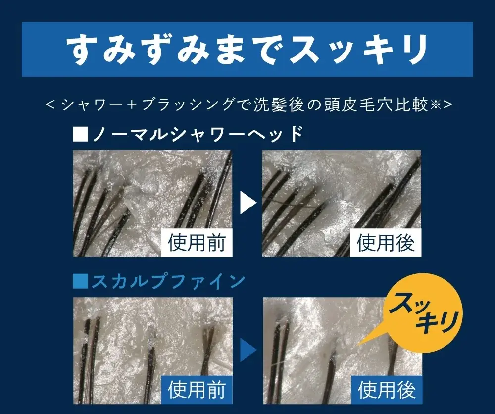 【家電大賞2025-2026】頭皮ケア専用シャワー『スカルプファイン』でTKSが初のノミネート！ 画像 5